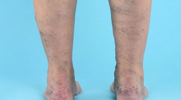 Krankheitserkrankung