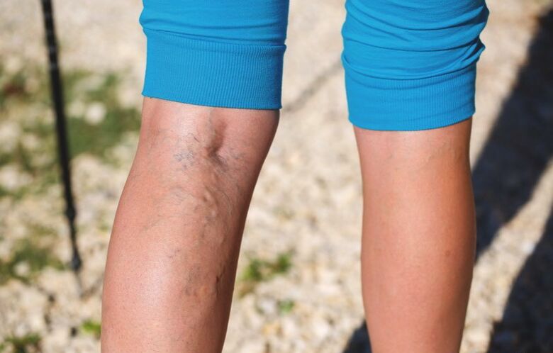 Schäden an den unteren Enden